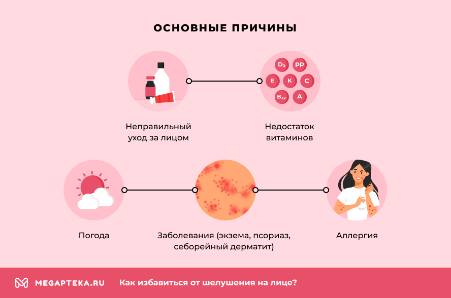 Основные причины