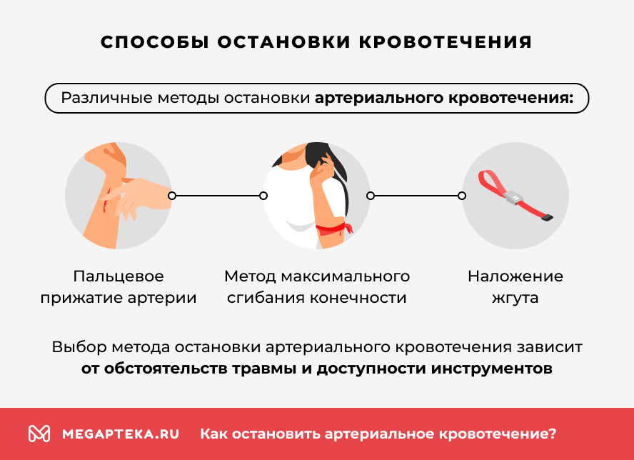 Способы остановки кровотечения