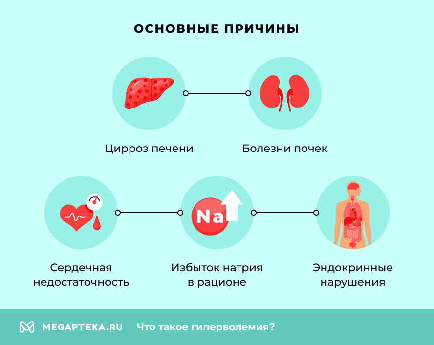 Основные причины