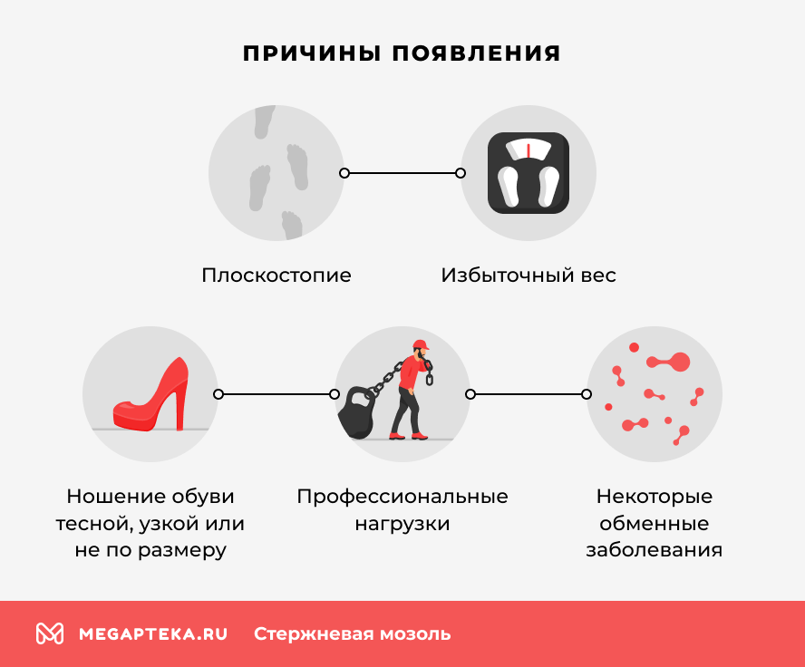 Причины появления