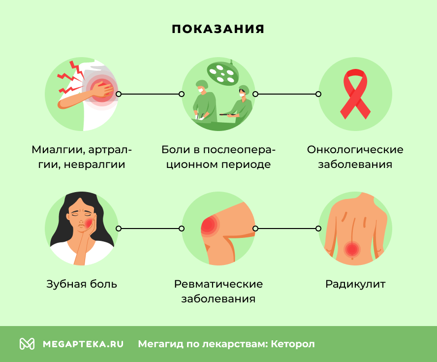 Кеторол сперматозоидтарға әсер ете ме? Кеторол сперматозоидтарға әсер ете ме?