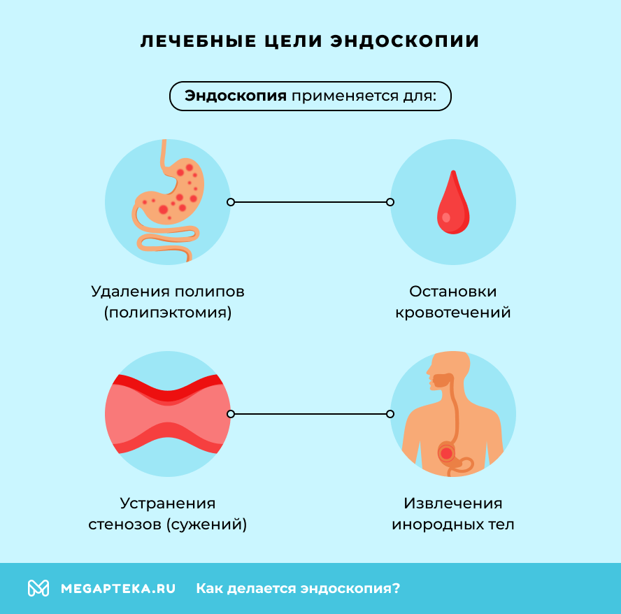 Лечебные цели эндоскопии
