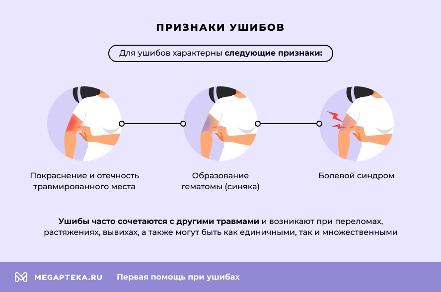Признаки ушибов