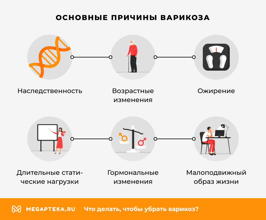 Основные причины варикоза