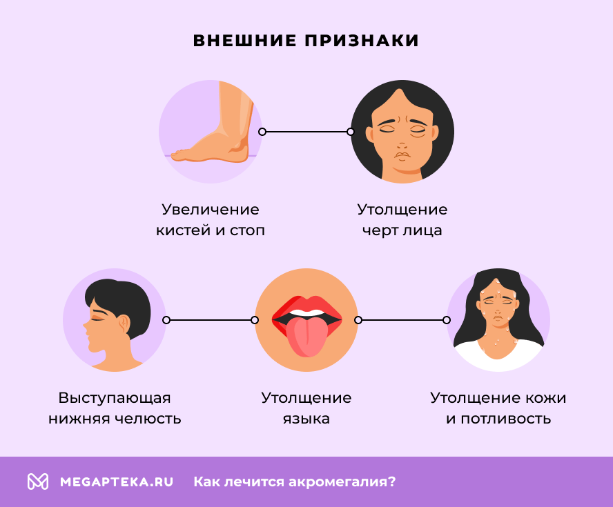 Внешние признаки