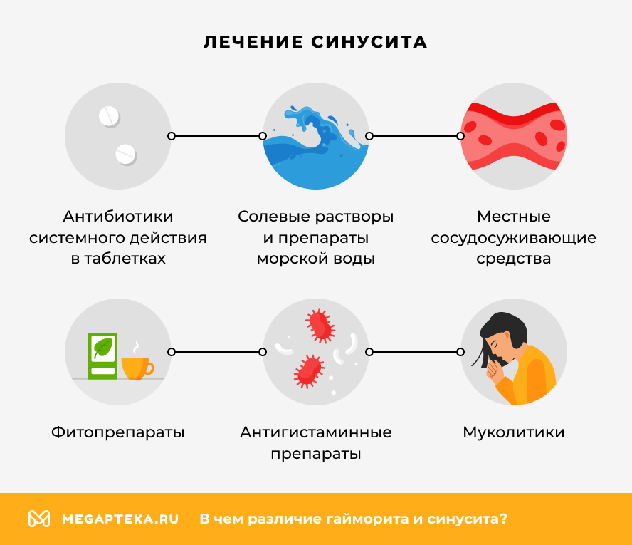 Лечение синусита
