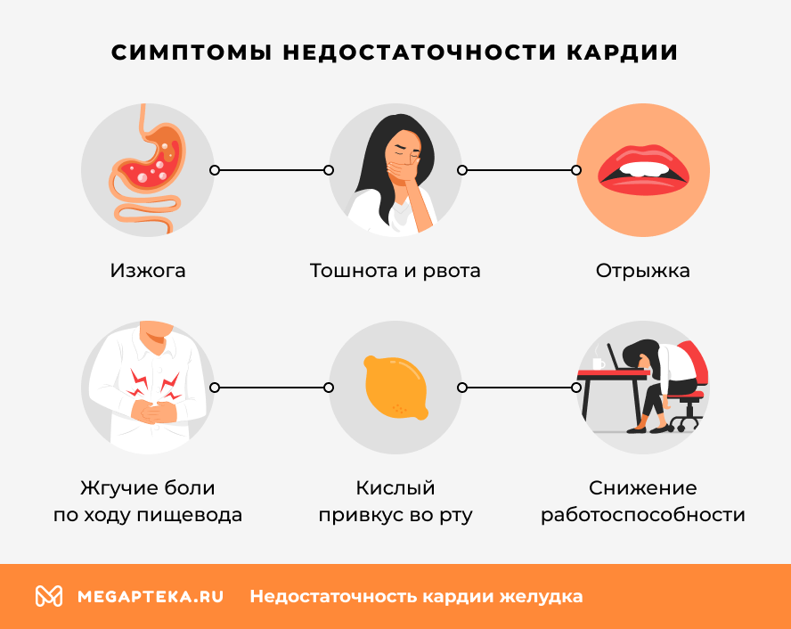 Симптомы недостаточности кардии