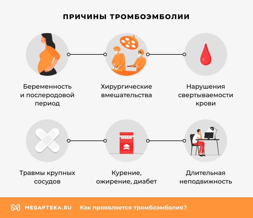 Причины тромбоэмболии