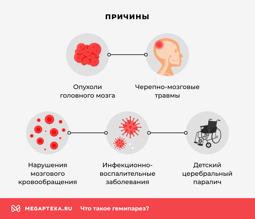 Причины