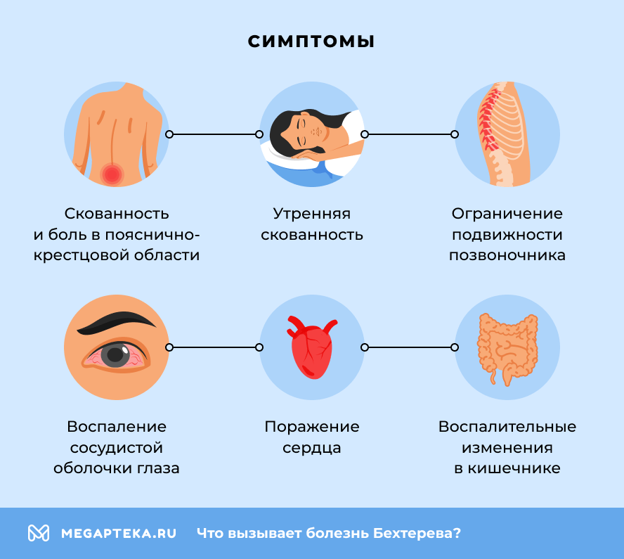 Симптомы