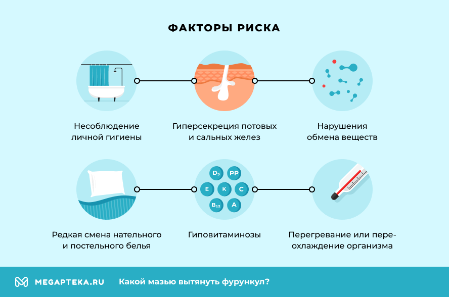 Факторы риска