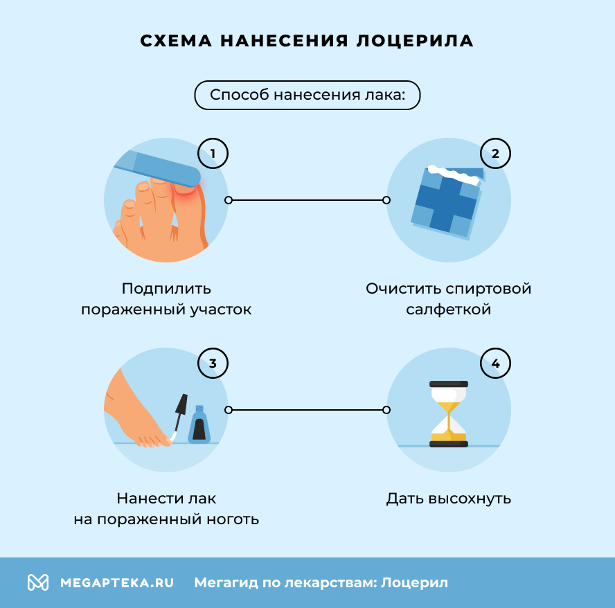 Схема нанесения