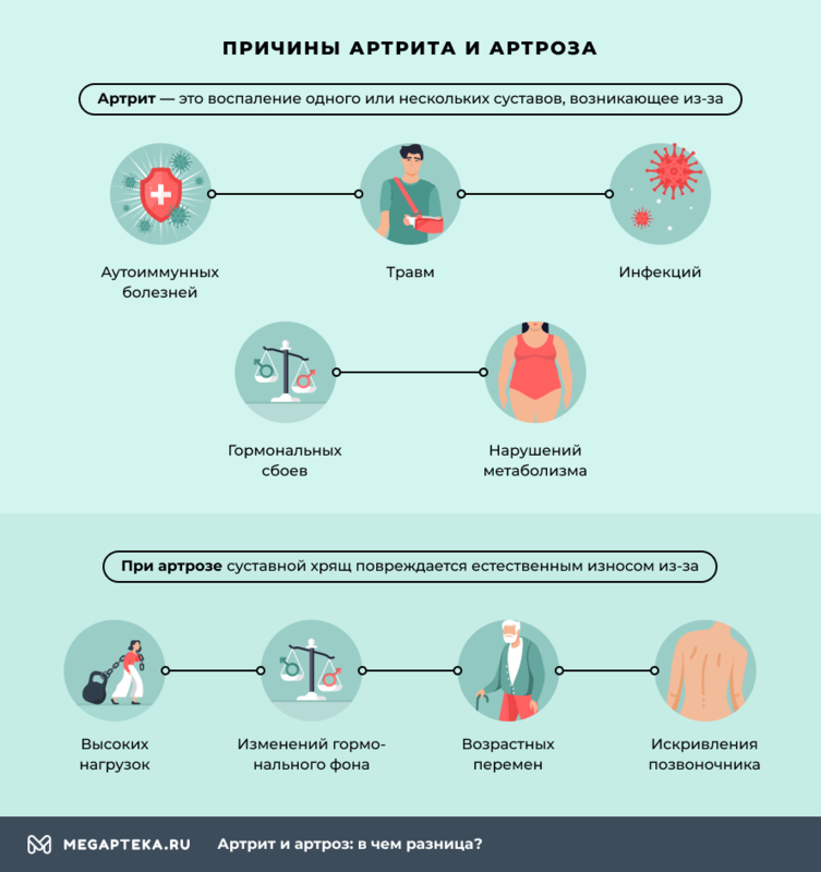 Артроз и артрит: в чем разница?