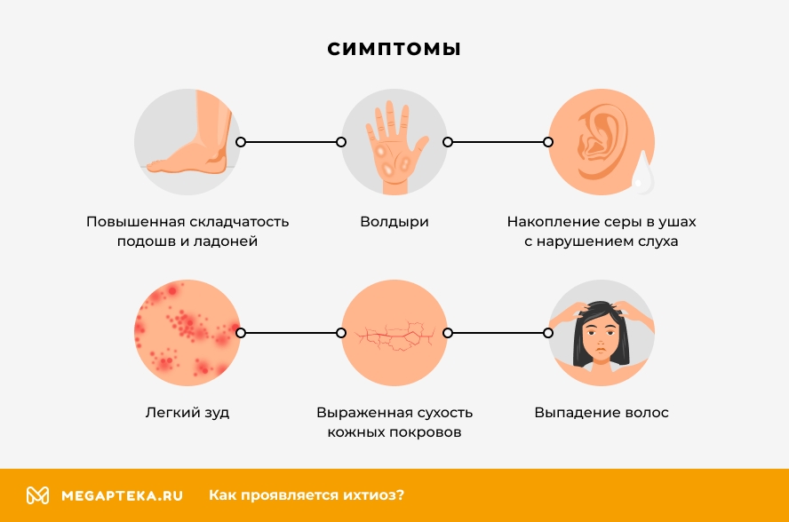 Симптомы