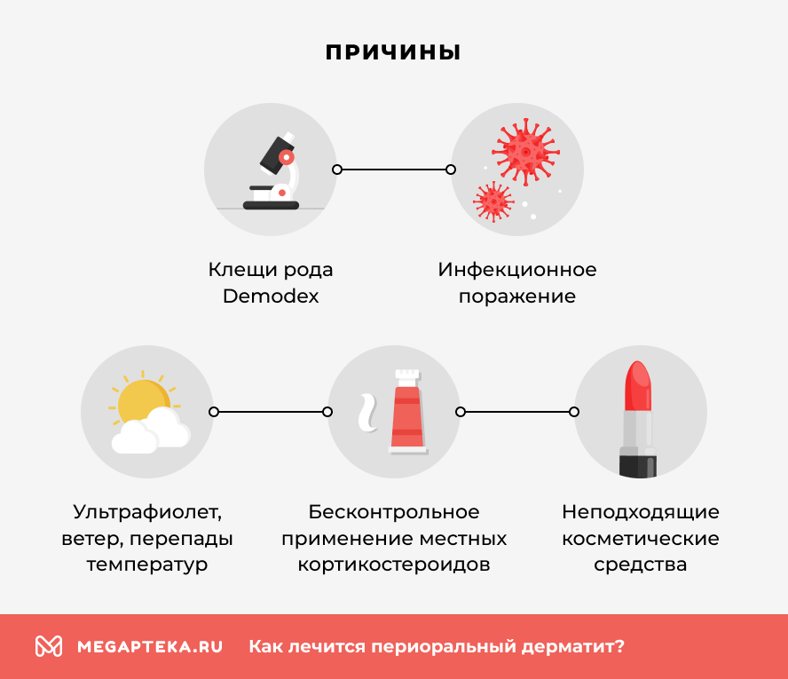 Причины