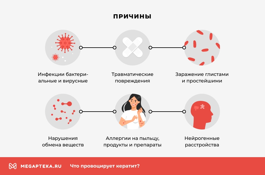 Кератит глаза причины, симптомы и лечение: Клинические рекомендации