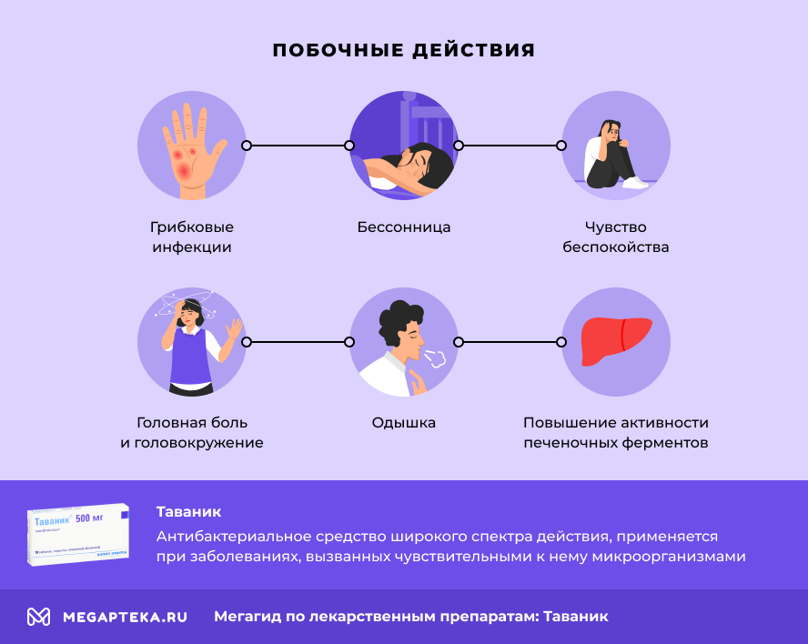 Таваник при простатите схема