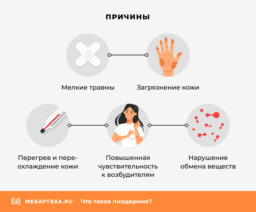 Причины
