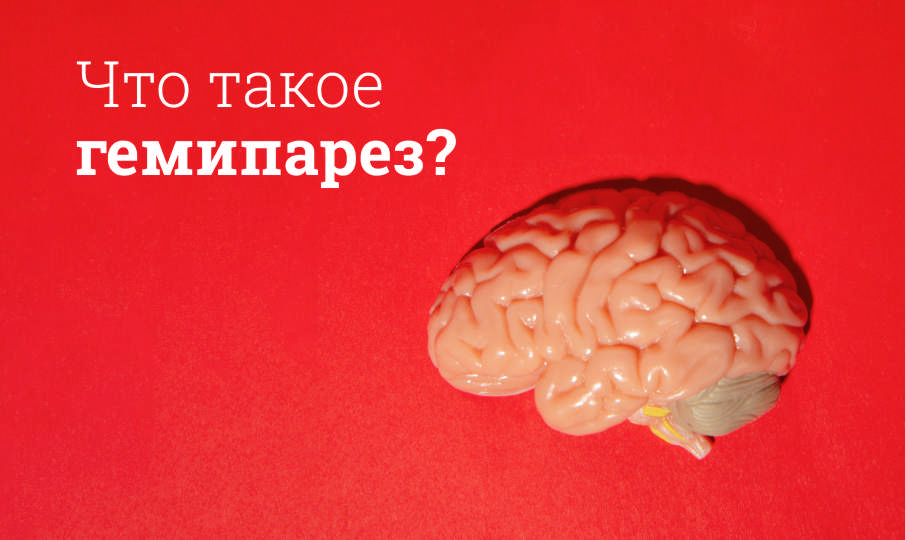 Что такое гемипарез?