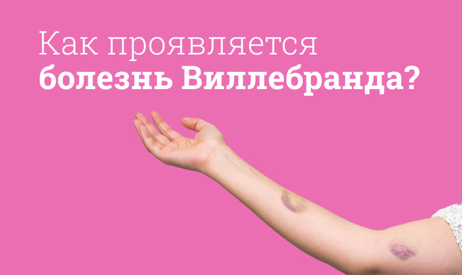 Болезнь Виллебранда