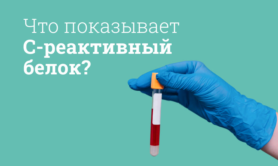 Что показывает С-реактивный белок?