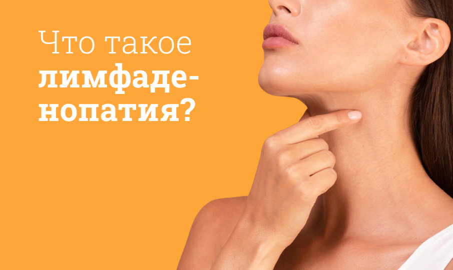 Что такое лимфаденопатия?