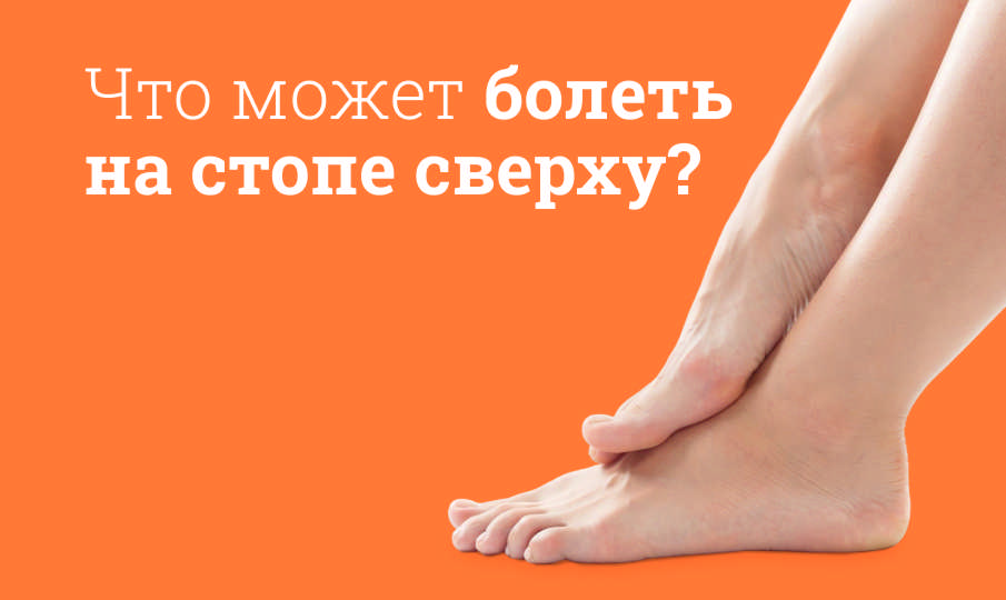 Почему болит стопа сверху?