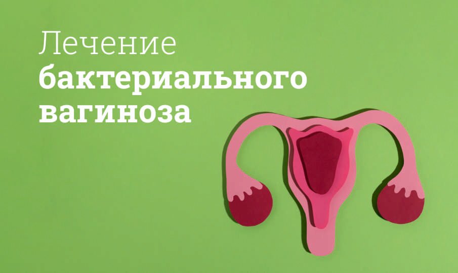 Лечение бактериального вагиноза