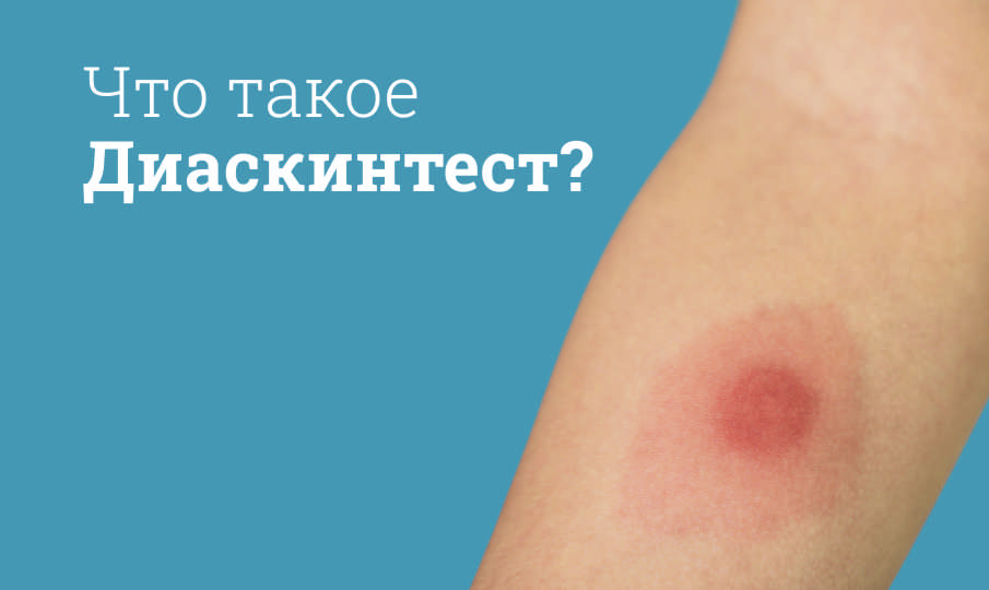 Диаскинтест инструкция по применению