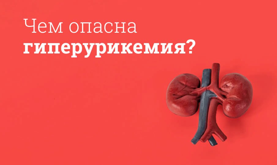 Чем опасна гиперурикемия? 