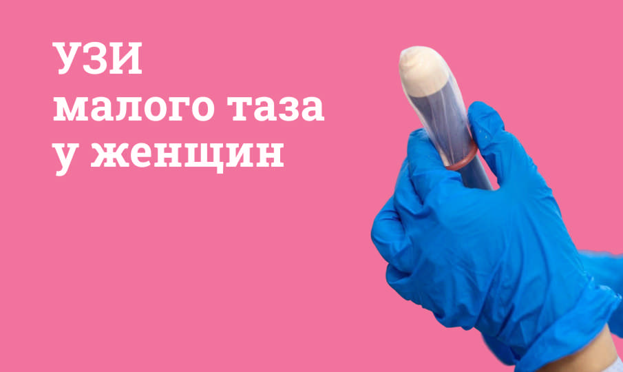 УЗИ малого таза у женщин