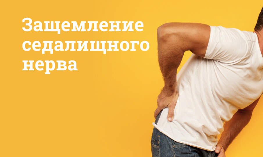 Защемление седалищного нерва: Симптомы и лечение, упражнения