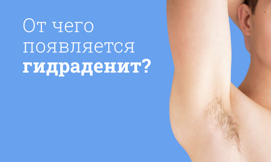 Симптомы и лечение гидраденита