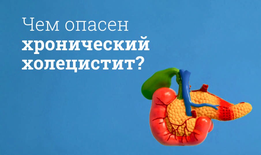 Холецистит хронический