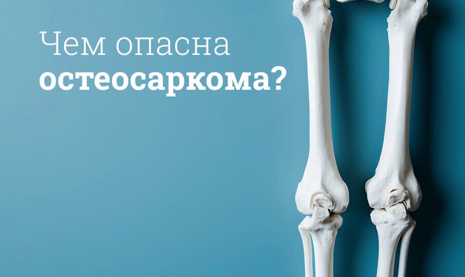 Симптомы и лечение остеосаркомы