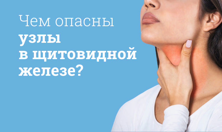 Узлы в щитовидной железе