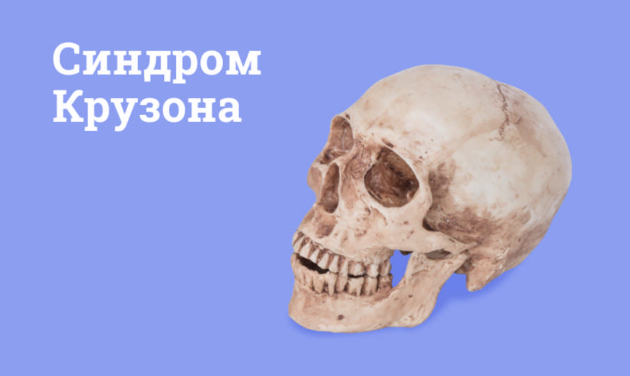 Синдром Крузона