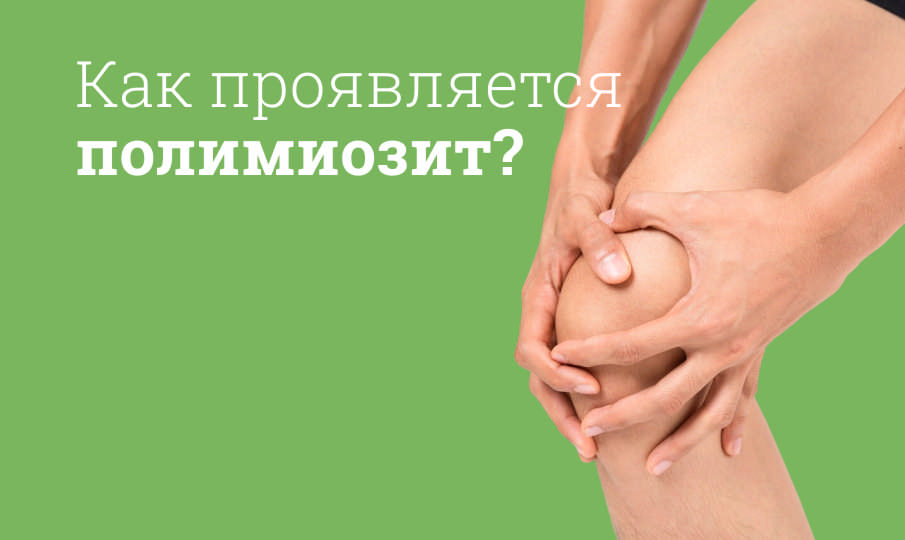 Что такое полимиозит?