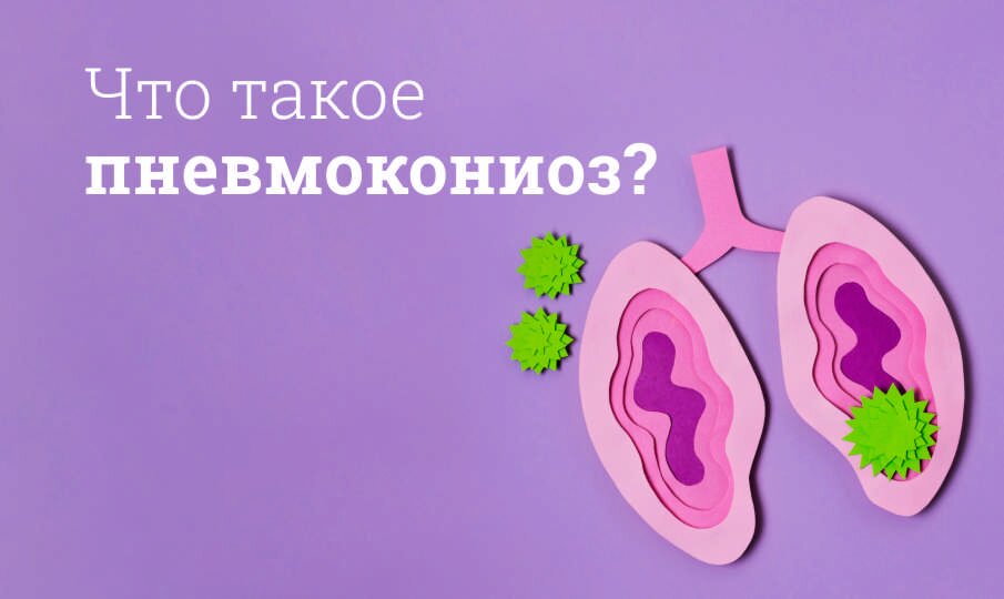 Пневмокониоз: лечение и симптомы