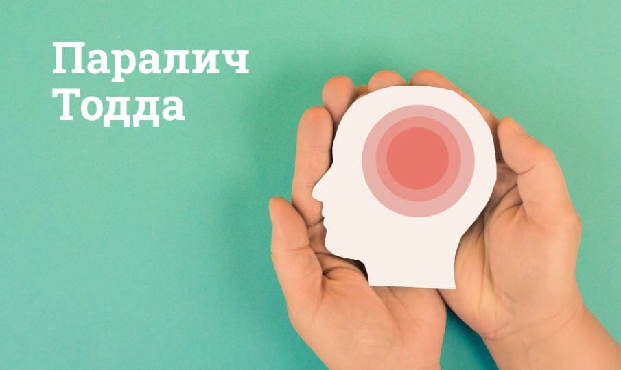 Паралич Тодда