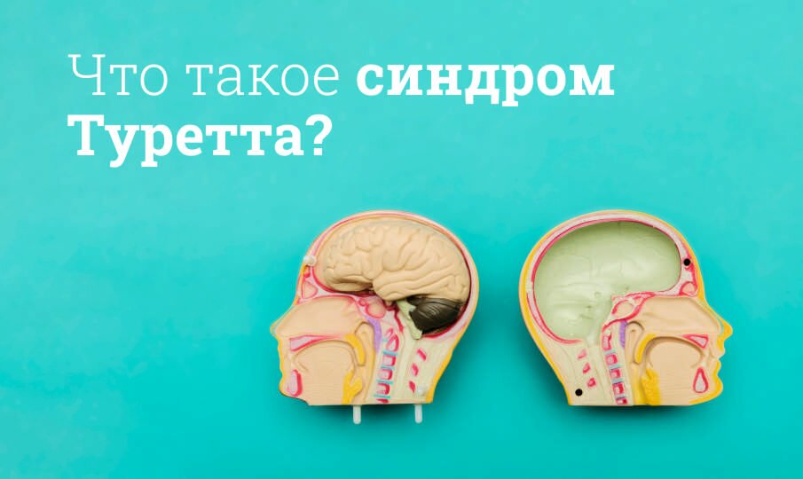 Лечение синдрома Туретта