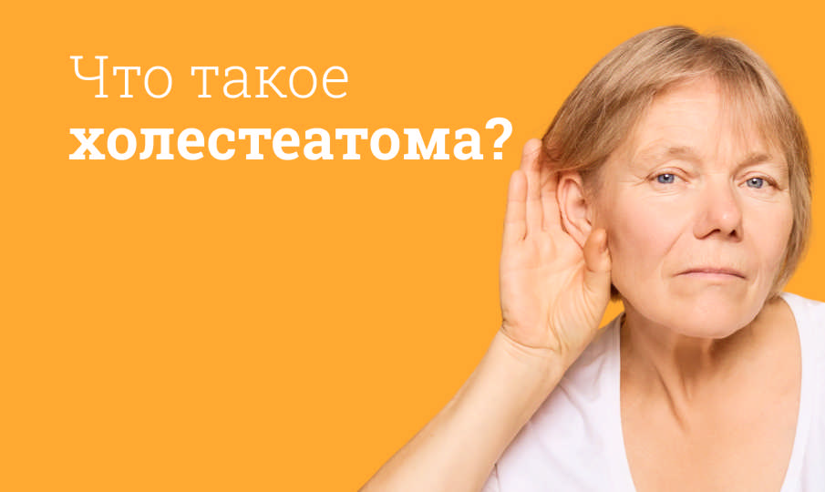 Что такое холестеатома?