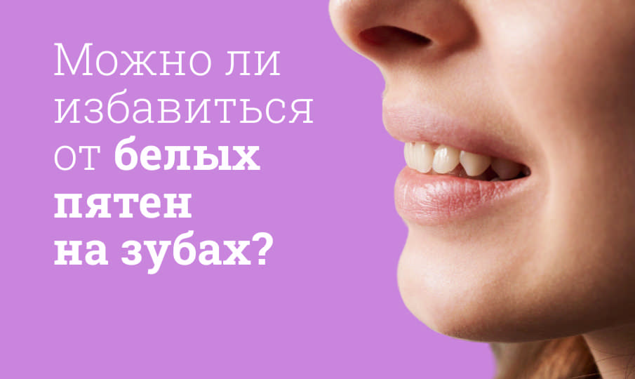Почему появляются белые пятна на зубах?
