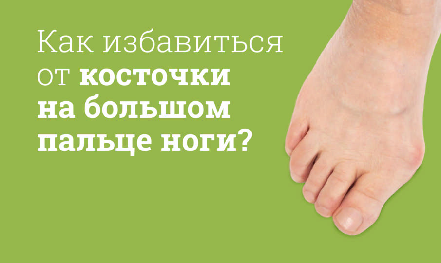 Как избавиться от косточки на ноге у большого пальца?
