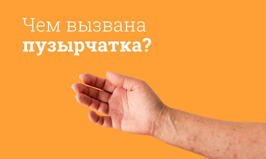 Препараты для лечения пузырчатки