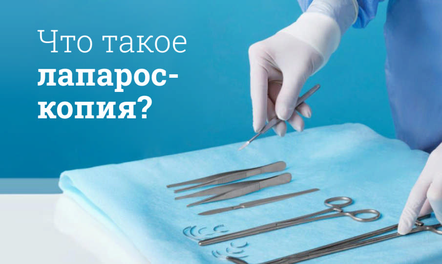 Что такое лапароскопия?