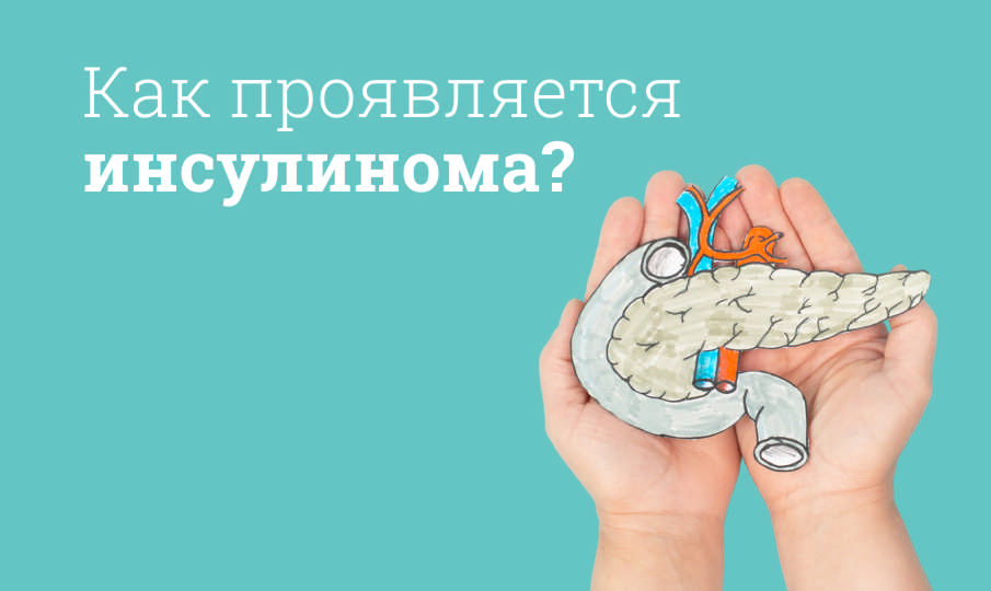 Что такое инсулинома?