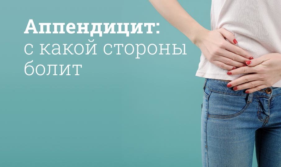 Признаки хронического аппендицита