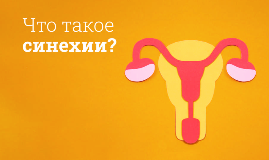 Что такое синехии?