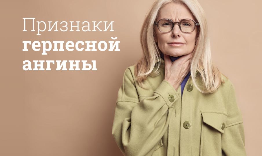 Герпесная ангина